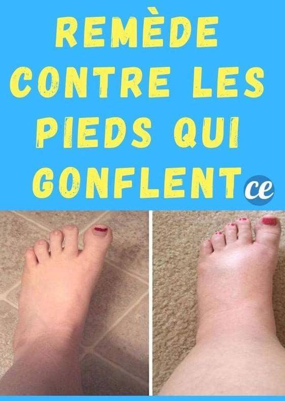 Soulagement immédiat et durable avec Botulinum Toxin & Bee Venom – Le secret contre les douleurs persistantes