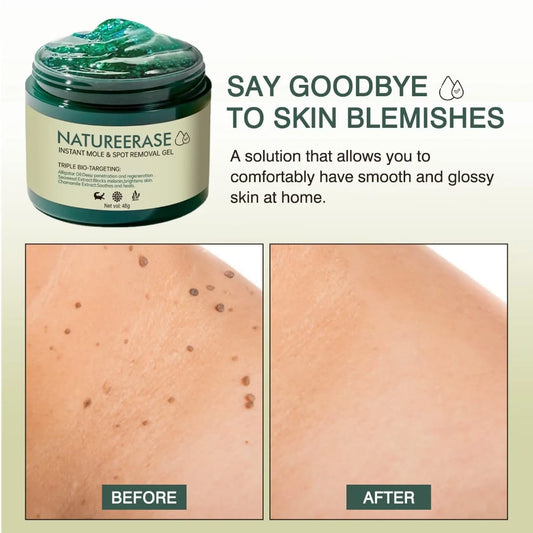 ✨ NatureErase™ – Gel Instantané Anti-Taches & Grain de Beauté ✨